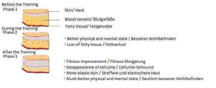 Vacuactivus InfraRunick treadmill